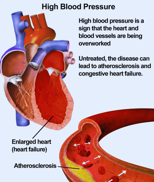 Blood Circulation